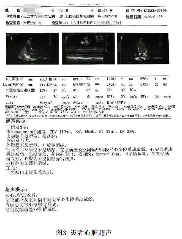 6638915ed54d1.png